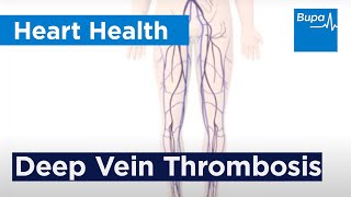 Wells Criteria for Deep Vein Thromboses DVTs EXPLAINED [upl. by Yart]