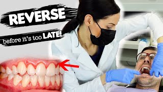 How To Treat Gum Disease [upl. by Elockin]