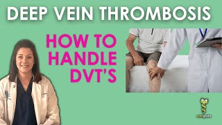 Deep Vein Thrombosis How to handle DVTs [upl. by Nyladnar400]