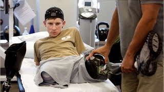 US soldier recovers after losing all four limbs [upl. by Ayor53]