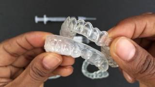 How to use Tooth Whitening Trays [upl. by Ttergram]