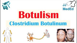 Botulism Clostridium Botulinum Pathogenesis Symptoms Diagnosis Treatment Prevention [upl. by Acitel253]