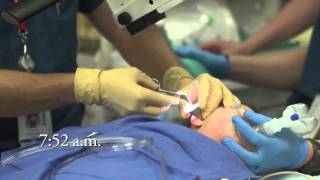 Chunky Earwax Removal  Auburn Medical Group [upl. by Jud]