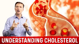 The Cholesterol Test You Should Be Getting [upl. by Beeck]