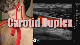 Carotid Artery Ultrasound [upl. by Lalat988]