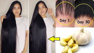 চুল লম্বা হবে দ্বিগুন গতিতে  30 Days Double Hair Growth Challenge [upl. by Atinra]