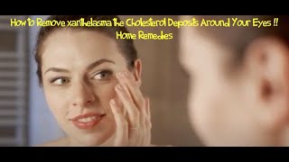 How to Remove xanthelasma the Cholesterol Deposits Around Your Eyes  Home Remedies [upl. by Akoyin]