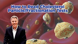 Cholesterol  What to Test  LDLP Explained Part 4 [upl. by Tanitansy444]