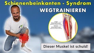 Shin Splints Schienenbeinkantensyndrom  Die 3 Besten Übungen  Ursache amp Lösung [upl. by Arehs]