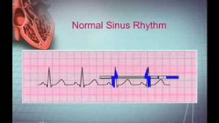 Intro EKG Interpretation Part 1 [upl. by Manaker]