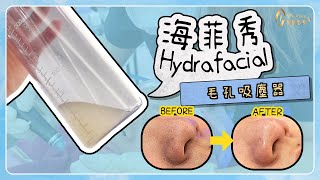 【醫美分享】海菲秀HydraFacial水飛梭，毛孔吸塵器，粉刺的剋星 [upl. by Racklin]