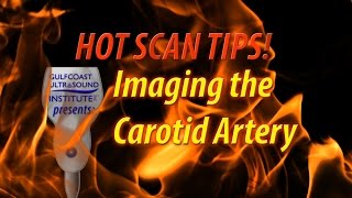 Secrets of Carotid Ultrasound [upl. by Barimah]