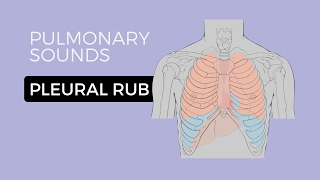 How to Interpret a Chest XRay Lesson 8  Focal Lung Processes [upl. by Lockwood]