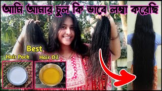 চুল লম্বা করার সহজ উপায় ॥ Fast Hair Growth Remedies ॥ Hair Growth Tips ॥ Chul Lomba Korar Tel 👍 [upl. by Maddie699]