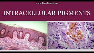 Intracellular pigments [upl. by Nodnal]