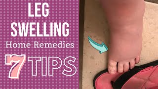 7 Tips for Leg Swelling Treatment at Home Hindi [upl. by Danette]