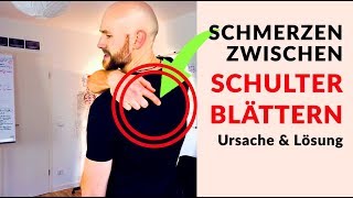 Schmerzen zwischen den Schulterblättern lösen  Ursache amp Lösung in Mobility amp Dehnung [upl. by Curcio]