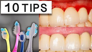 10 Tips To Reduce Swollen Gums At Home [upl. by Ainod933]