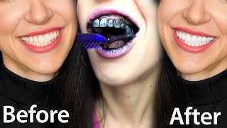 Fastest Way To Whiten Teeth At Home What REALLY Works [upl. by Hollerman156]