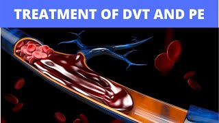 Treatment of DVT and PE [upl. by Eirek]